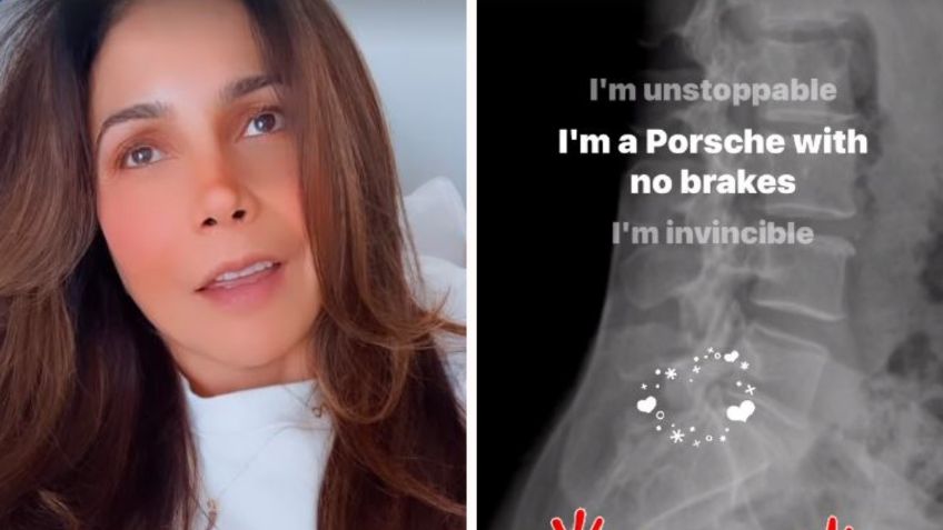 Patricia Manterola preocupa a sus fans con inquietante mensaje sobre su salud: “no me puedo mover”