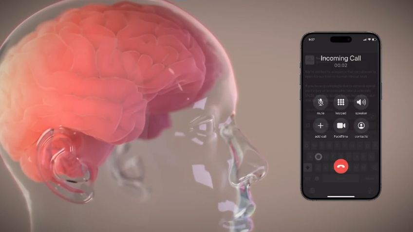 Neuralink: Elon Musk anuncia éxito en su primera prueba de implante cerebral en humanos