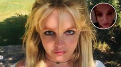 Britney Spears sufre quemaduras en el rostro por una explosión en su casa: "Me dolía que me tocaran"