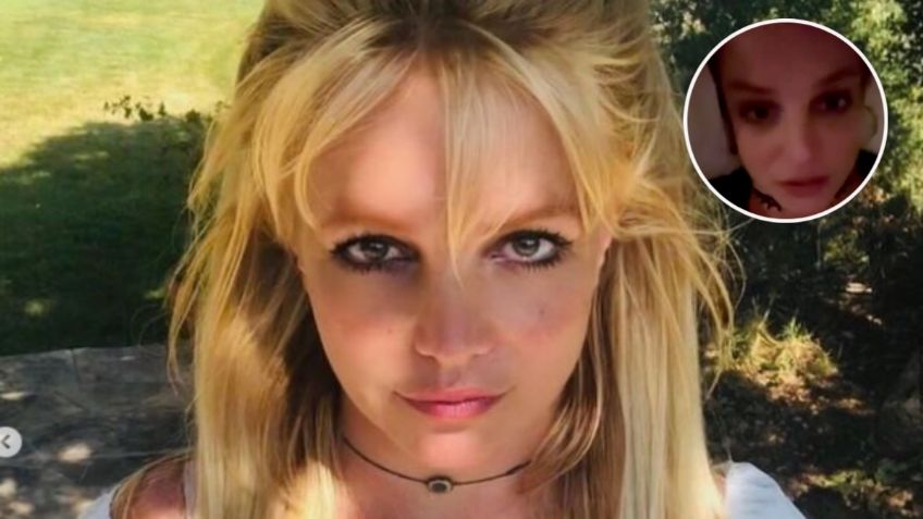 Britney Spears sufre quemaduras en el rostro por una explosión en su casa: "Me dolía que me tocaran"