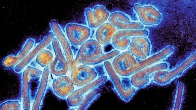 El Virus de Marburgo visto desde el microscopio, el cual puede ser mortal.