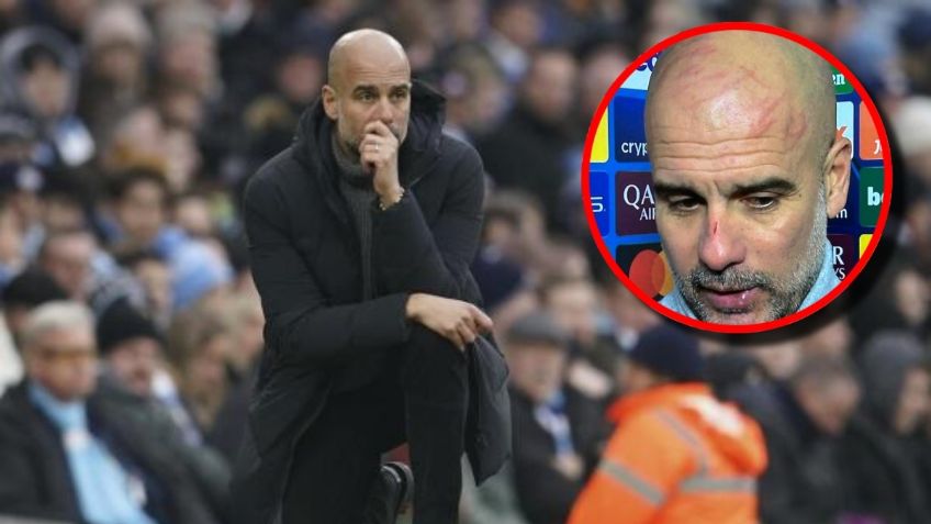 Esta es la razón por la que Pep Guardiola apareció "golpeado" en la Champions League | VIDEO