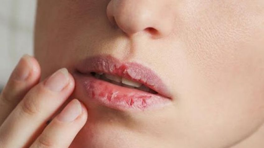 Los mejores bálsamos para aliviar el ardor de los labios producido por los fuertes vientos y el polvo