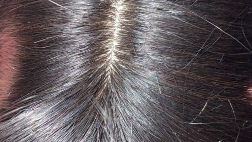 Cuál es la técnica ideal para ocultar las canas sin teñirte todo el cabello