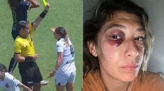 "No me sentí protegida": la futbolista Mónica Alvarado reclama tras recibir codazo en un partido