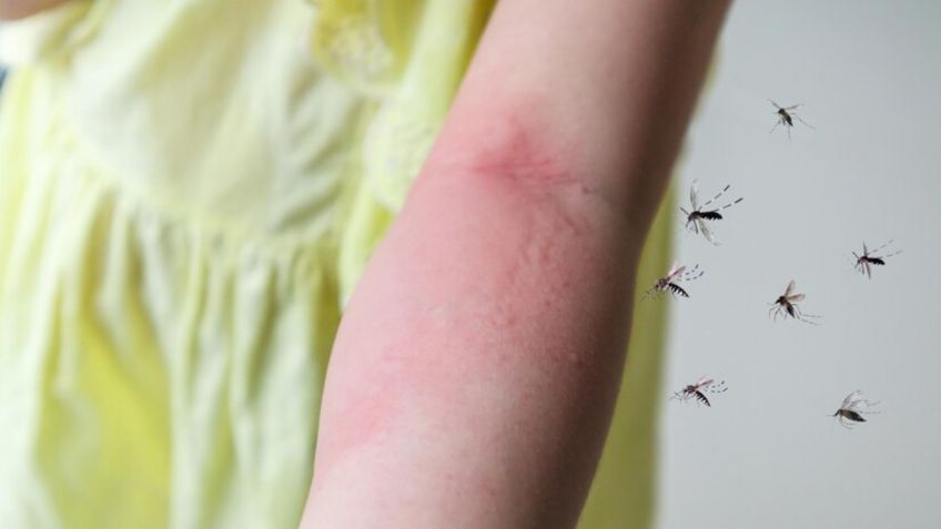 3 métodos para prevenir las picaduras de mosquito a la hora de dormir