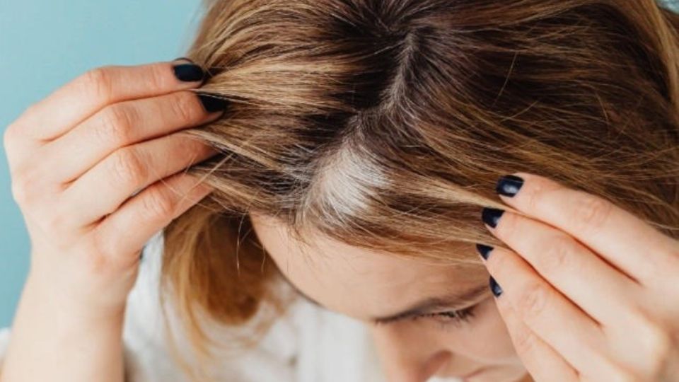 La hieloterapia ayuda a eliminar las canas