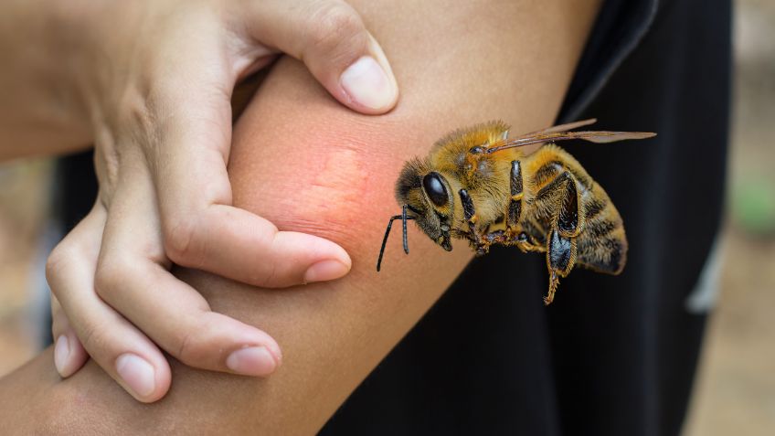 Qué hacer si me pica una abeja, según especialistas