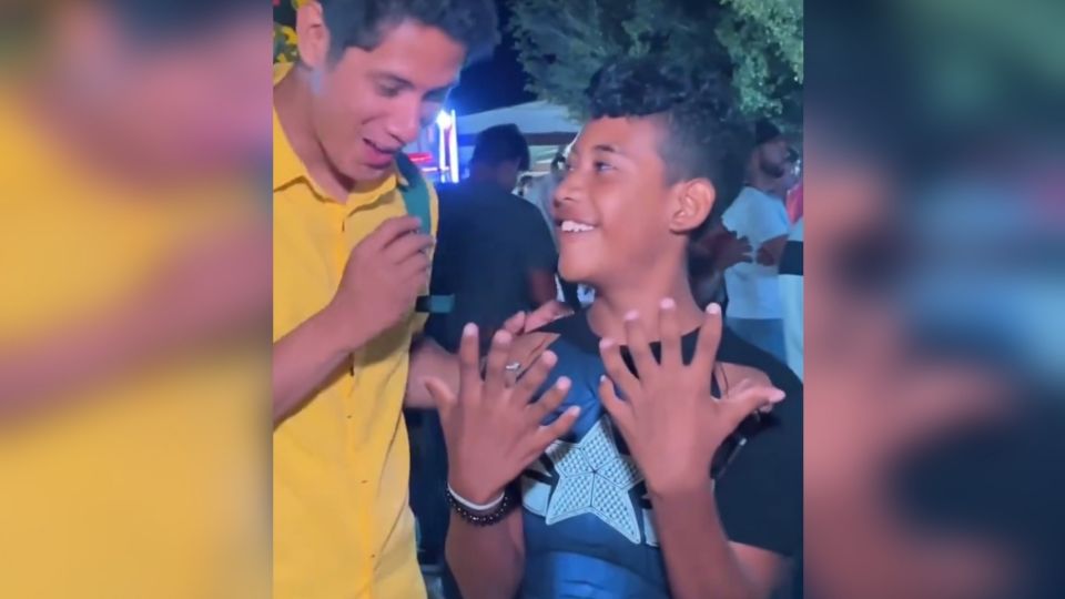 Niño en Veracruz sorprende con su 'mejor talento' al mostrar sus seis dedos en cada mano