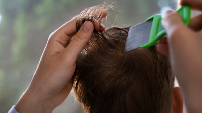 Vinagre blanco, el ingrediente casero más efectivo para eliminar piojos y liendres en temporada de calor