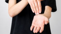 El significado de que te pique la mano izquierda que no todos conocen