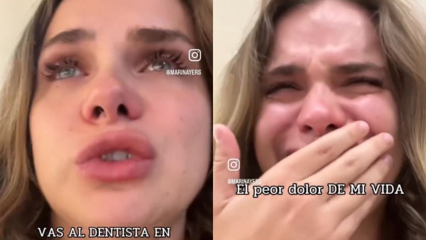 Influencer viajó hasta Tailandia para blanquearse los dientes y terminó con fuertes dolores por una mala aplicación