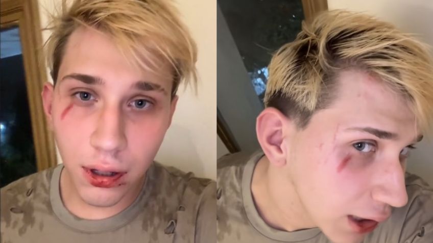 Influencer argentino denuncia que famoso cantante lo golpeó junto a sus amigos