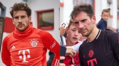 ¿Los esteroides te dejan sin cabello? Esta podría ser la causa de la sorpresiva calvicie de León Goretzka