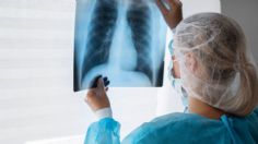 ¿Qué le pasó a Paul, hombre que pensó que tenía problemas de gases cuando en realidad sufría un colapso pulmonar?