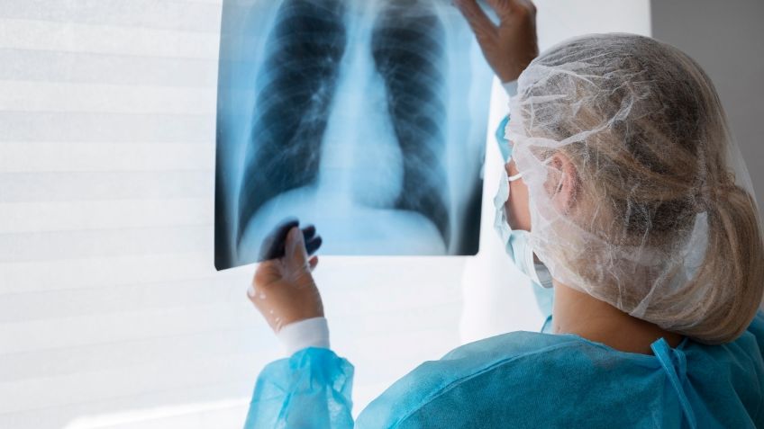 ¿Qué le pasó a Paul, hombre que pensó que tenía problemas de gases cuando en realidad sufría un colapso pulmonar?