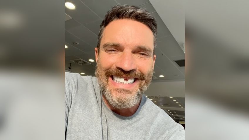 Julián Gil pierde un diente y sufre grave lesión tras incidente en “La Isla”