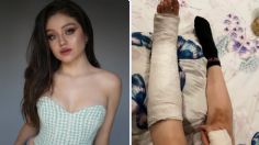 Karol Sevilla reaparece en muletas tras sufrir aparatoso accidente en su casa