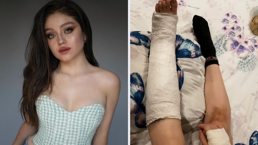 Karol Sevilla reaparece en muletas tras sufrir aparatoso accidente en su casa