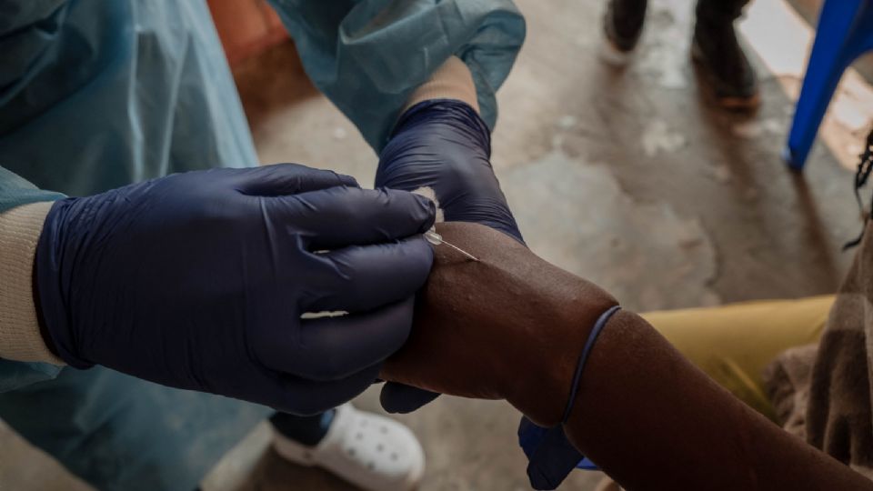 La actual emergencia por la propagación de la viruela del mono, o mpox, ha levantado alarmas en todo el mundo.