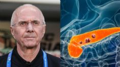 ¿Qué es el cáncer de páncreas, principales causas y síntomas de la enfermedad que mató a Sven-Göran Eriksson?