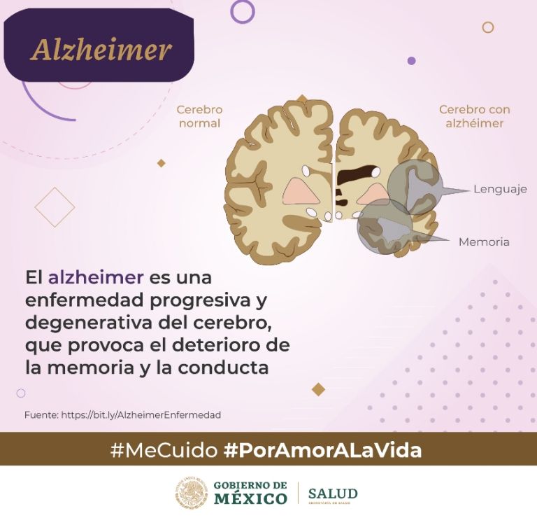 alzheimer mexico