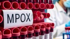 Secretaría de Salud de Oaxaca alerta posible caso de viruela del mono Mpox