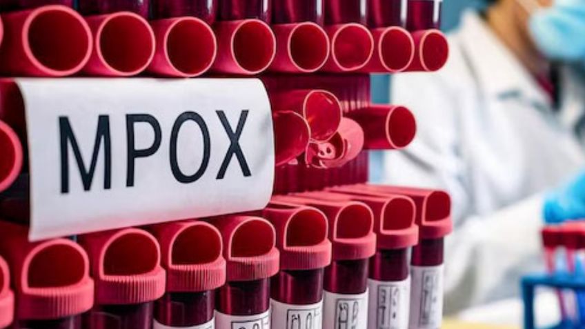 Secretaría de Salud de Oaxaca alerta posible caso de viruela del mono Mpox