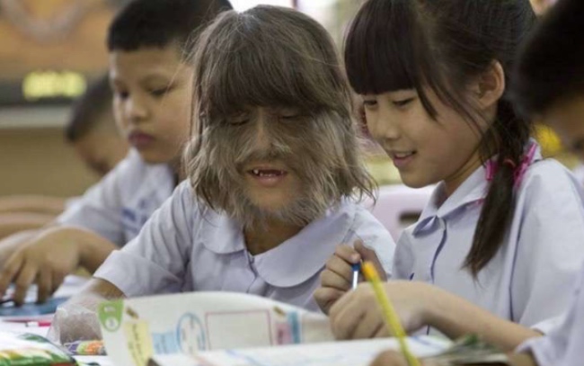 En 2010 fue considerada la mujer más peluda del mundo. FOTO: Bronek Kaminski